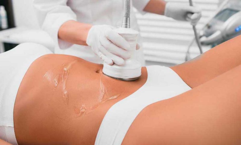 4 CAVITATION
